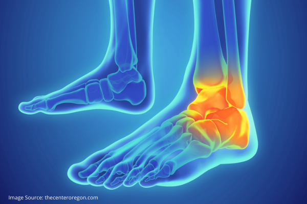 first aid for ankle sprain
