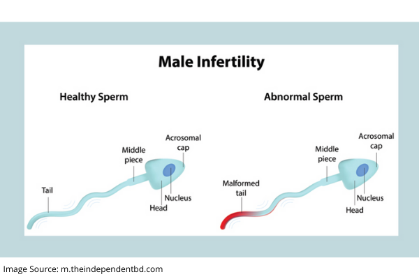CAUSES OF INCREASED INFERTILITY IN MEN