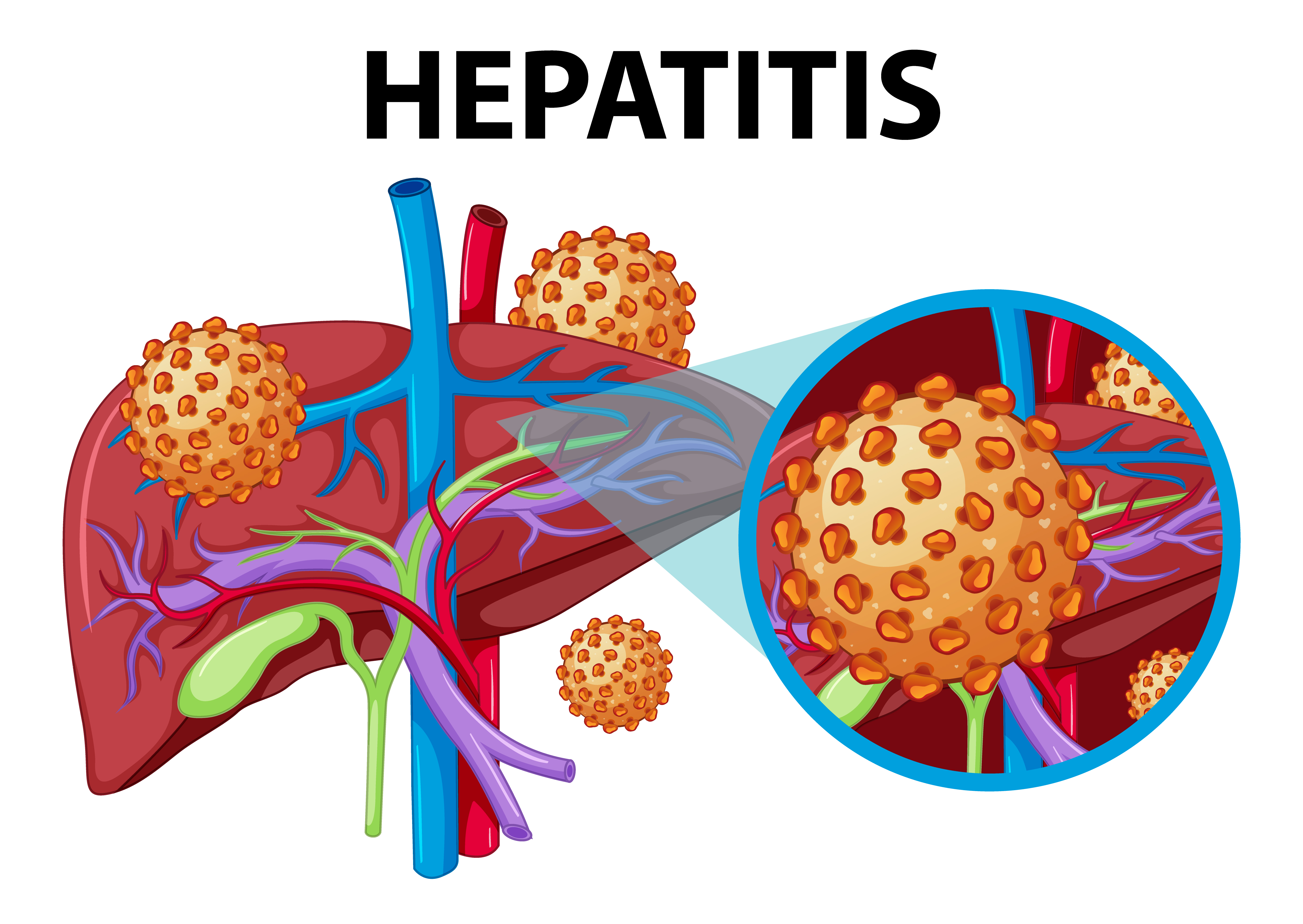 World Hepatitis Day